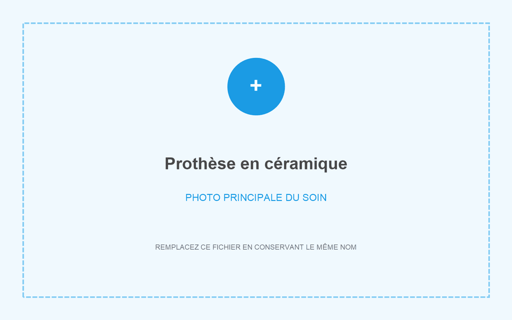 Prothèse en céramique réalisée à Grandental Clinic