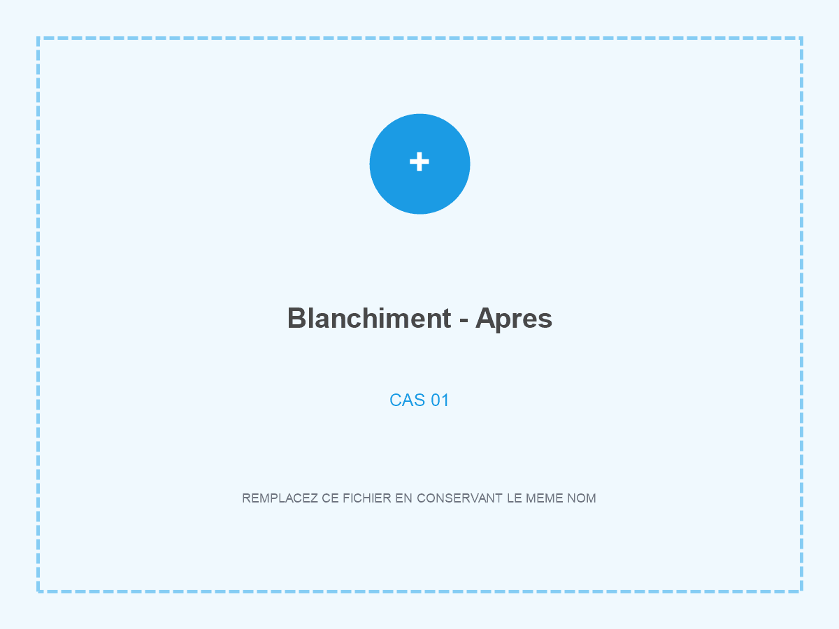 Sourire après blanchiment dentaire