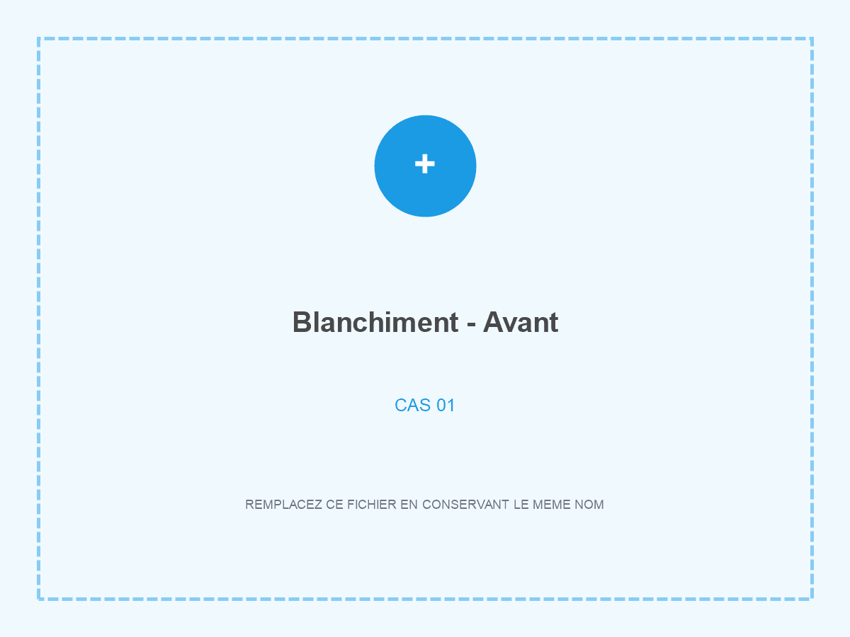 Sourire avant blanchiment dentaire