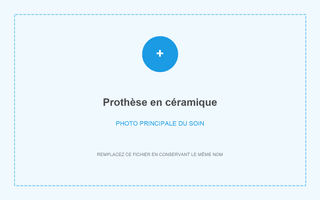 Prothèse en céramique réalisée à Grandental Clinic