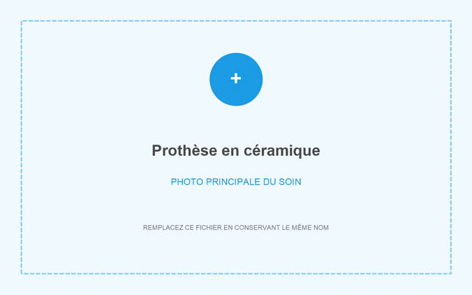 Prothèse en céramique réalisée à Grandental Clinic