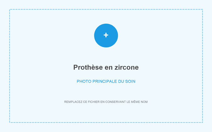 Couronne en zircone réalisée à Grandental Clinic