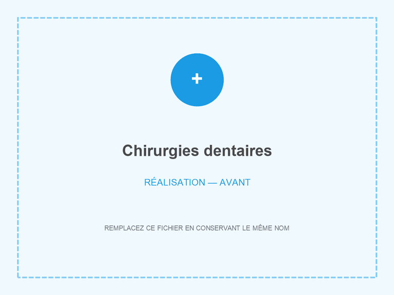 Situation clinique avant chirurgie dentaire
