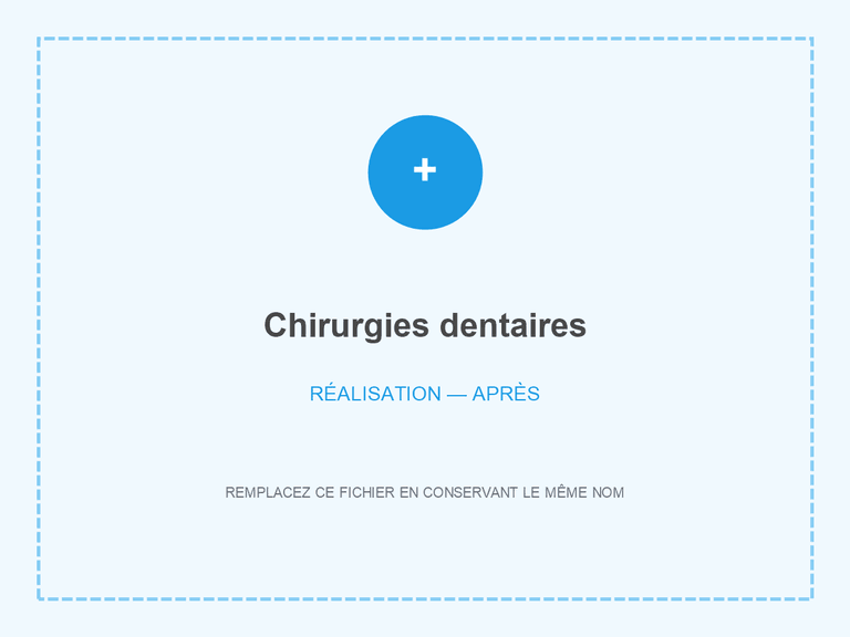 Contrôle après chirurgie dentaire