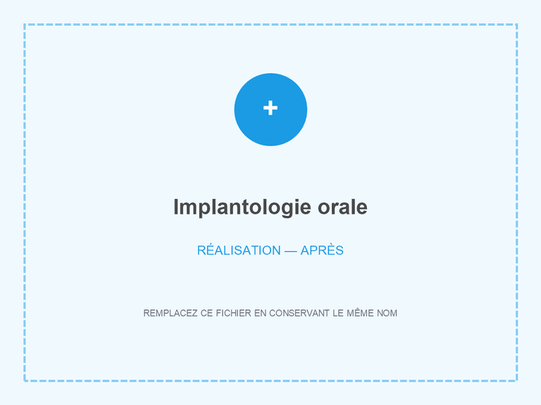 Résultat clinique après traitement implantaire