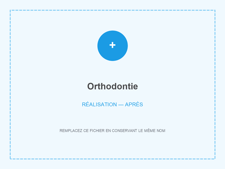 Alignement dentaire après traitement orthodontique