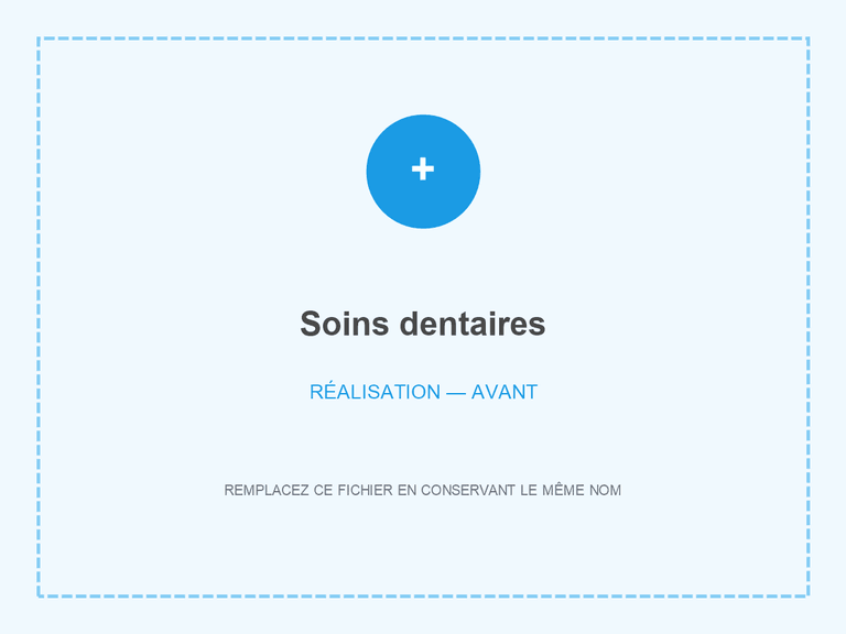 Situation avant soins dentaires