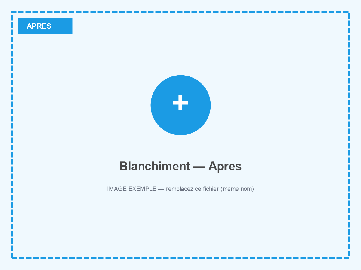 Sourire après blanchiment dentaire